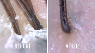 Q And A Everything You Need To Know About Fusio Scrub 2 Article Kérastase